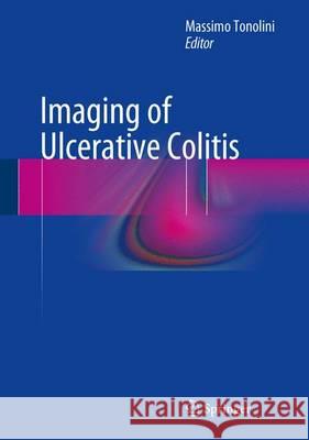 Imaging of Ulcerative Colitis Massimo Tonolini 9788847054080 Springer Verlag - książka