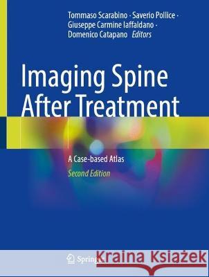 Imaging Spine After Treatment: A Case-Based Atlas Tommaso Scarabino Saverio Pollice Giuseppe Carmine Iaffaldano 9783031425509 Springer - książka