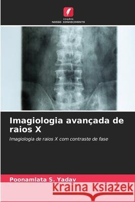 Imagiologia avan?ada de raios X Poonamlata S. Yadav 9786207576685 Edicoes Nosso Conhecimento - książka