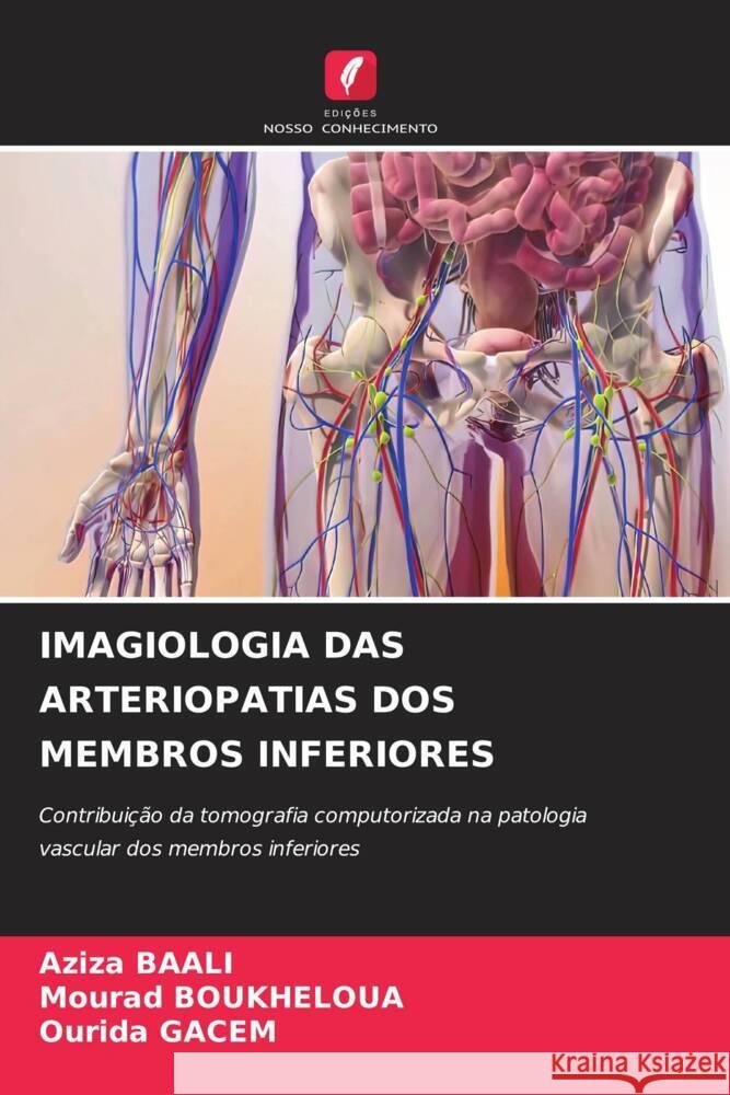 Imagiologia Das Arteriopatias DOS Membros Inferiores Aziza Baali Mourad Boukheloua Ourida Gacem 9786207322503 Edicoes Nosso Conhecimento - książka