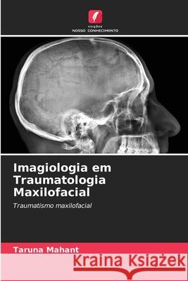 Imagiologia em Traumatologia Maxilofacial Mahant, Taruna 9786209279454 Edições Nosso Conhecimento - książka