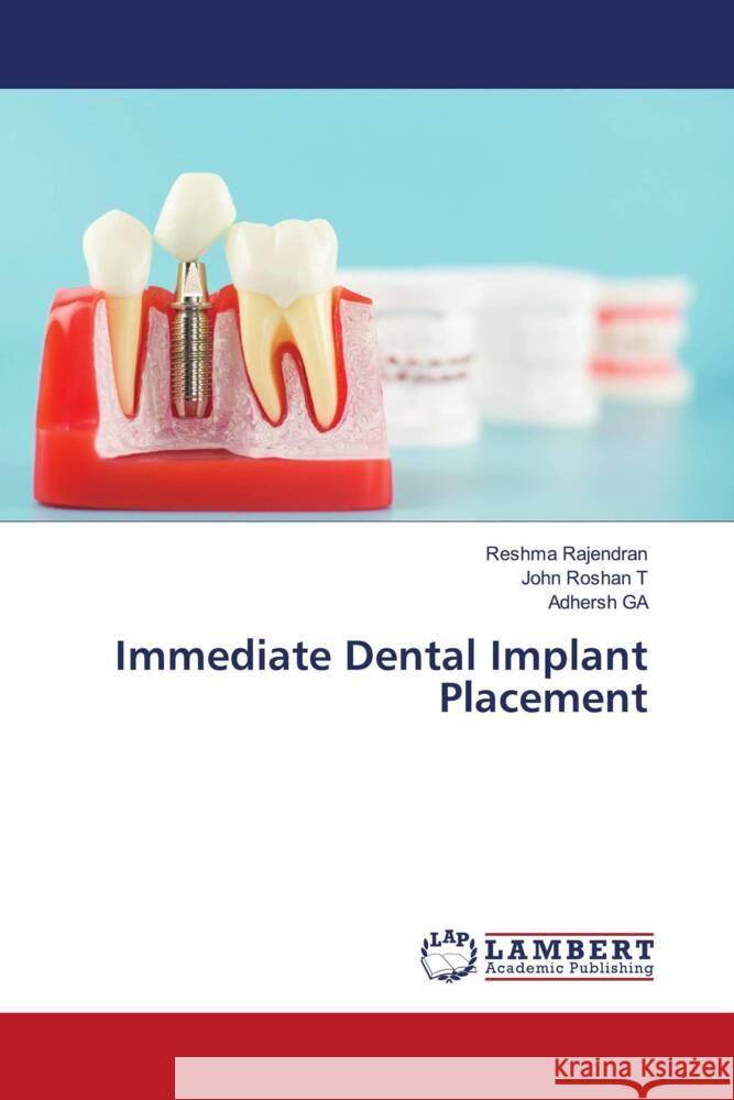 Immediate Dental Implant Placement Rajendran, Reshma, Roshan  T, John, GA, Adhersh 9786207996155 LAP Lambert Academic Publishing - książka