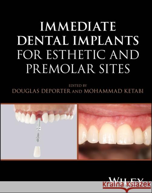 Immediate Dental Implants for Esthetic and Premolar Sites Mohammad (University of Toronto, ON, Canada) Ketabi 9781394187102  - książka