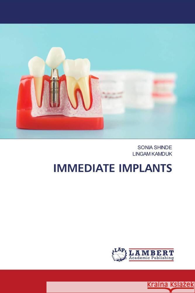 Immediate Implants Sonia Shinde Lingam Kamduk 9786205513620 LAP Lambert Academic Publishing - książka