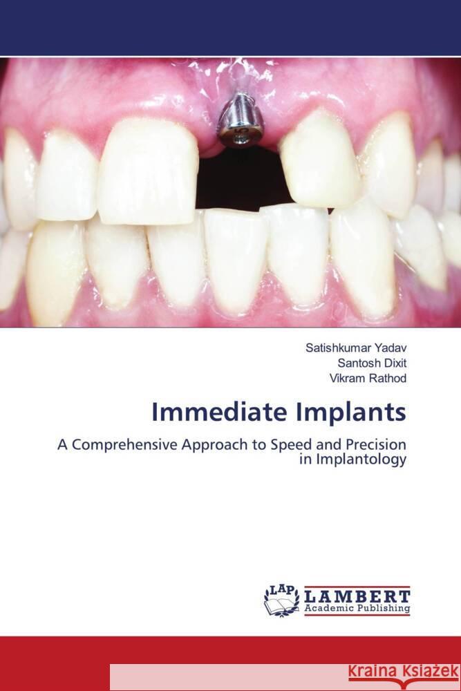 Immediate Implants Satishkumar Yadav Santosh Dixit Vikram Rathod 9786207995509 LAP Lambert Academic Publishing - książka