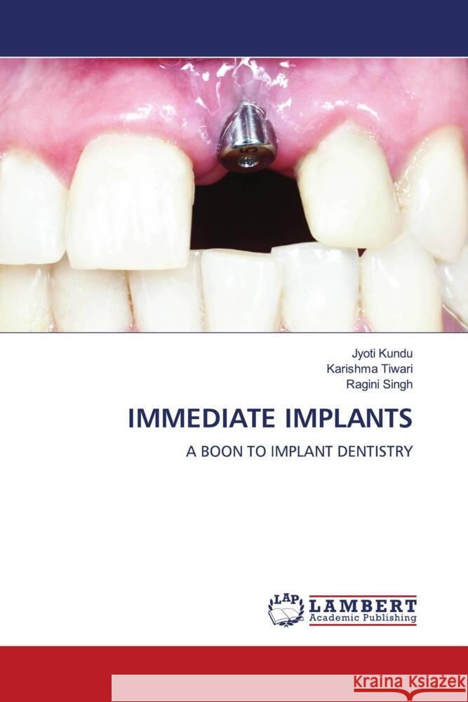 IMMEDIATE IMPLANTS Kundu, Jyoti, Tiwari, Karishma, Singh, Ragini 9786208444143 LAP Lambert Academic Publishing - książka