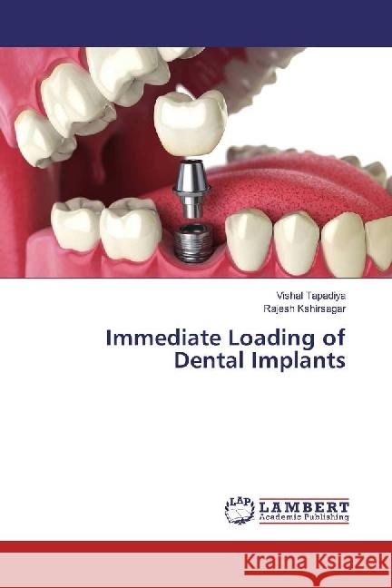 Immediate Loading of Dental Implants Tapadiya, Vishal; Kshirsagar, Rajesh 9786202028950 LAP Lambert Academic Publishing - książka