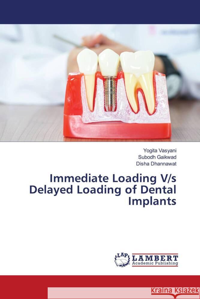 Immediate Loading V/s Delayed Loading of Dental Implants Yogita Vasyani Subodh Gaikwad Disha Dhannawat 9786207844203 LAP Lambert Academic Publishing - książka