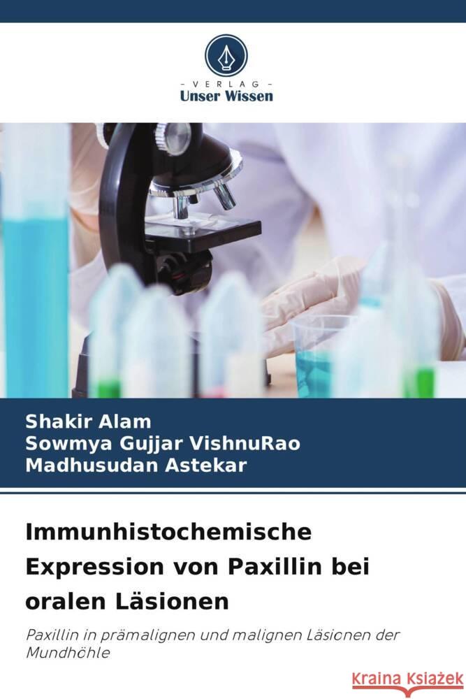 Immunhistochemische Expression von Paxillin bei oralen Läsionen Alam, Shakir, Gujjar VishnuRao, Sowmya, Astekar, Madhusudan 9786206367161 Verlag Unser Wissen - książka