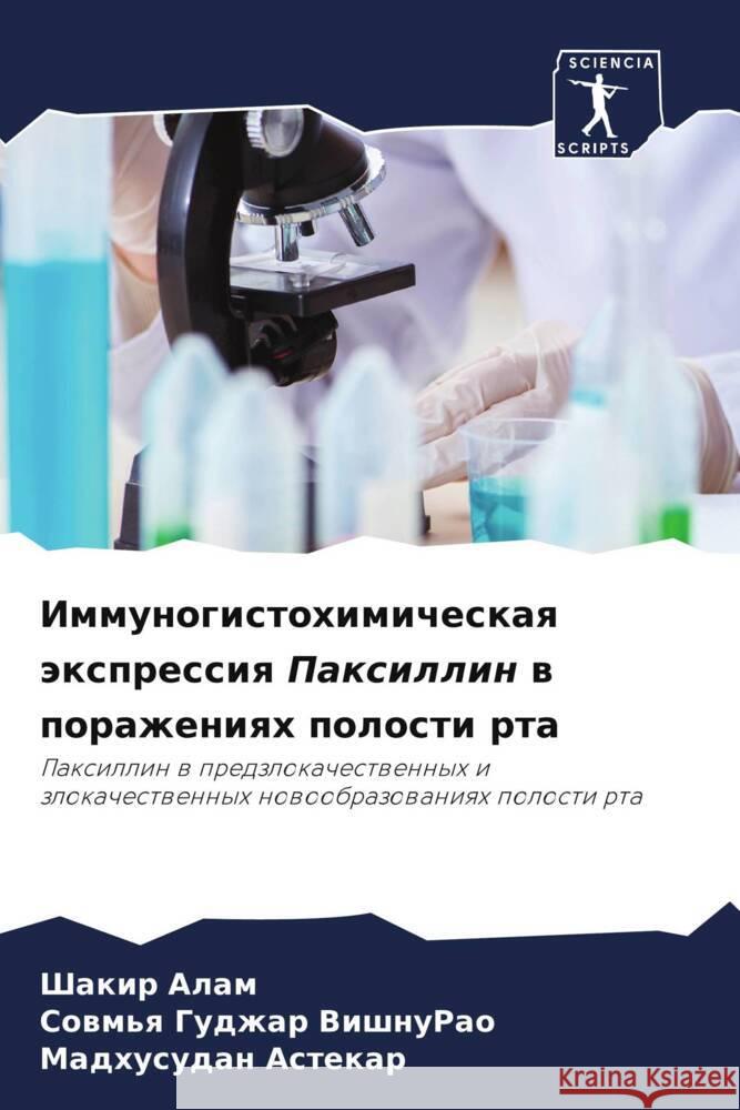 Immunogistohimicheskaq äxpressiq Paxillin w porazheniqh polosti rta Alam, Shakir, Gudzhar VishnuRao, Sowm'q, Astekar, Madhusudan 9786206367215 Sciencia Scripts - książka