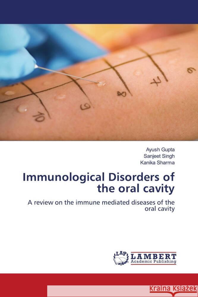 Immunological Disorders of the oral cavity Gupta, Ayush, Singh, Sanjeet, Sharma, Kanika 9786200078452 LAP Lambert Academic Publishing - książka