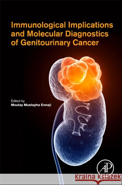 Immunological Implications and Molecular Diagnostics of Genitourinary Cancer Moulay Mustapha Ennaji 9780323854962 Academic Press - książka