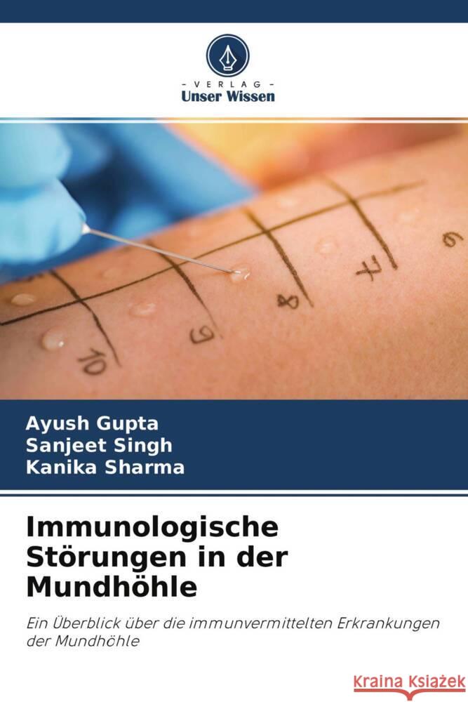 Immunologische Störungen in der Mundhöhle Gupta, Ayush, Singh, Sanjeet, Sharma, Kanika 9786204702995 Verlag Unser Wissen - książka