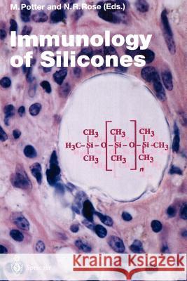 Immunology of Silicones Michael Potter Noel Rose 9783642852282 Springer - książka