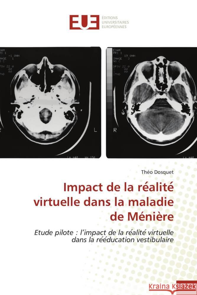 Impact de la re alite  virtuelle dans la maladie de Ménière Dosquet, Théo 9786203422399 Éditions universitaires européennes - książka