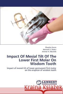 Impact of Mesial Tilt of the Lower First Molar on Wisdom Tooth Araim Shaalan, S Shakir Marwah, A Mustafa Ammar 9783659318092 LAP Lambert Academic Publishing - książka