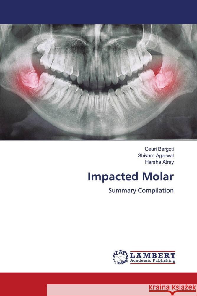 Impacted Molar Bargoti, Gauri, Agarwal, Shivam, Atray, Harsha 9786204979120 LAP Lambert Academic Publishing - książka