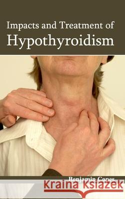 Impacts and Treatment of Hypothyroidism Benjamin Copes 9781632422422 Foster Academics - książka