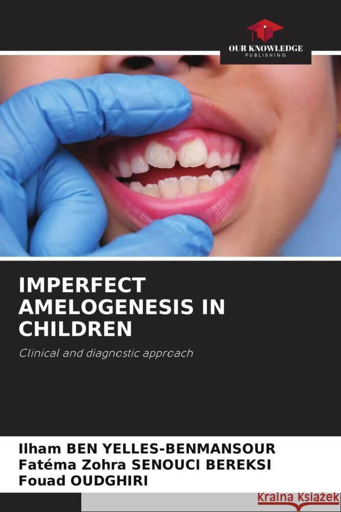 Imperfect Amelogenesis in Children Ilham Be Fat?ma Zohra Senouc Fouad Oudghiri 9786207198832 Our Knowledge Publishing - książka