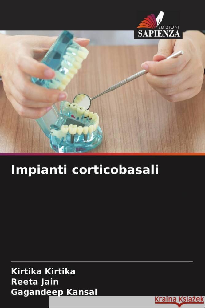 Impianti corticobasali Kirtika, Kirtika, Jain, Reeta, Kansal, Gagandeep 9786208347666 Edizioni Sapienza - książka