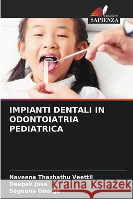 IMPIANTI DENTALI IN ODONTOIATRIA PEDIATRICA Thazhathu Veettil, Naveena, Jose, Deepak, George, Sageena 9786208649760 Edizioni Sapienza - książka