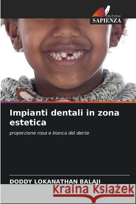 Impianti dentali in zona estetica Doddy Lokanathan Balaji 9786205653838 Edizioni Sapienza - książka