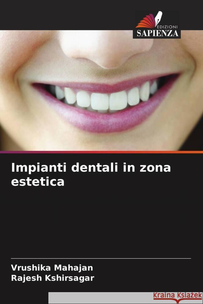 Impianti dentali in zona estetica Vrushika Mahajan Rajesh Kshirsagar 9786207259700 Edizioni Sapienza - książka