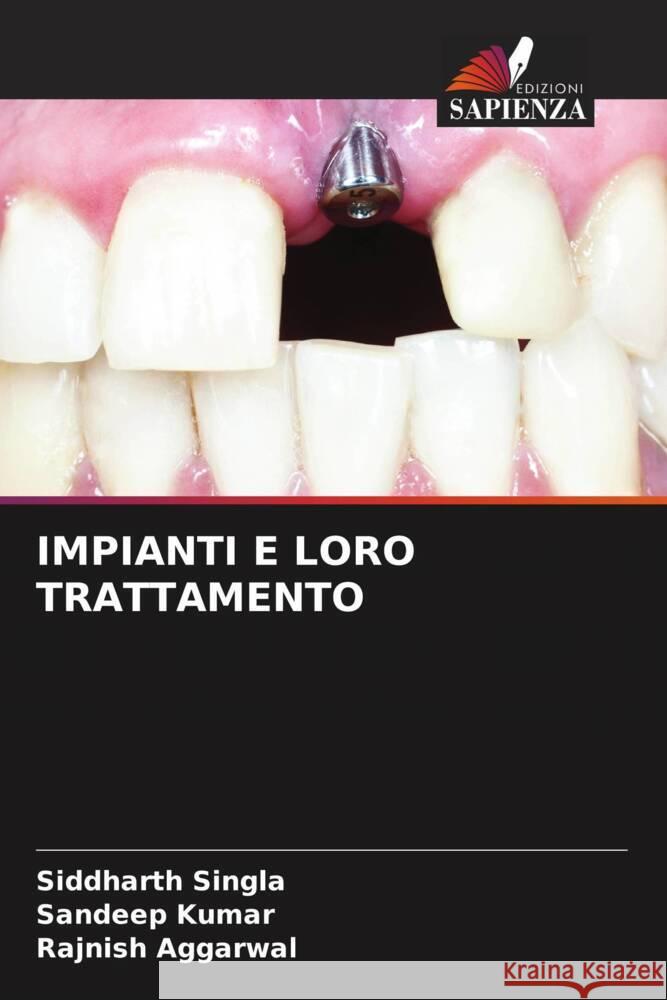 IMPIANTI E LORO TRATTAMENTO Singla, Siddharth, Kumar, Sandeep, AGGARWAL, RAJNISH 9786204993133 Edizioni Sapienza - książka