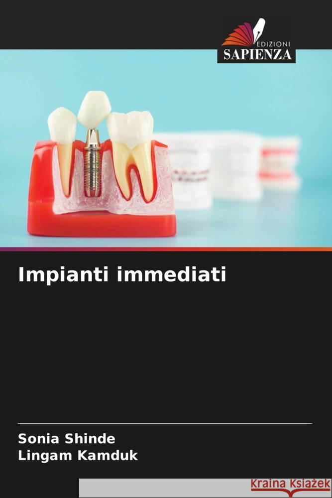 Impianti immediati SHINDE, SONIA, KAMDUK, LINGAM 9786208631499 Edizioni Sapienza - książka