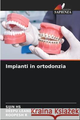 Impianti in ortodonzia HS, SIJIN, LEANDER, DEEPU, R, ROOPESH 9786208758455 Edizioni Sapienza - książka