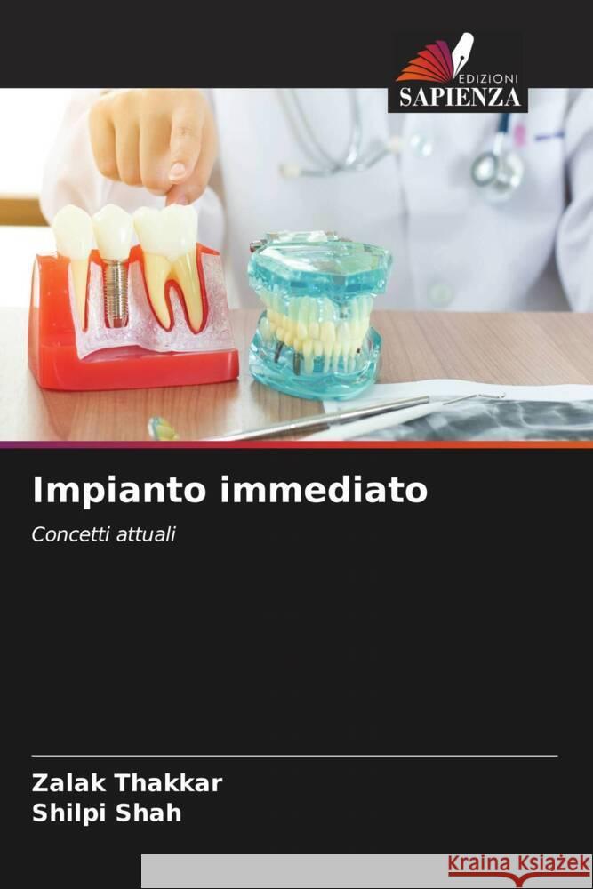 Impianto immediato Zalak Thakkar Shilpi Shah 9786206988021 Edizioni Sapienza - książka