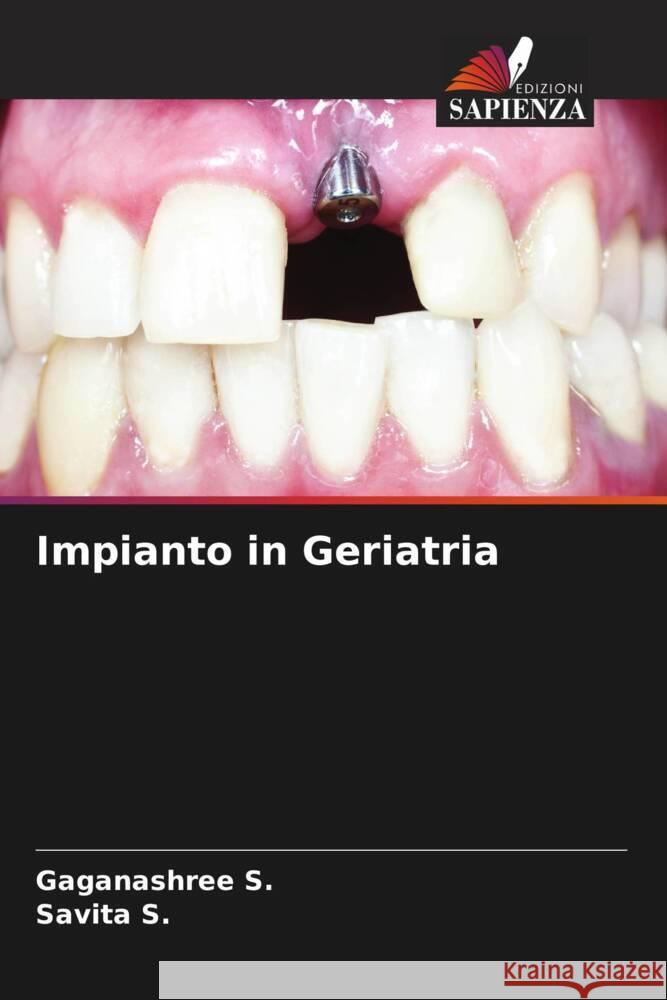 Impianto in Geriatria S., Gaganashree, S., Savita 9786206608653 Edizioni Sapienza - książka