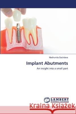 Implant Abutments Madhumita Sachdeva 9786202515665 LAP Lambert Academic Publishing - książka