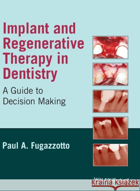 Implant and Regenerative Thera Fugazzotto, Paul A. 9780813829623 Wiley-Blackwell - książka