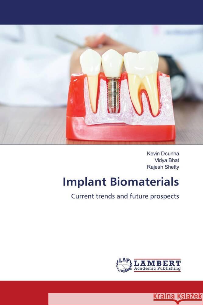 Implant Biomaterials Dcunha, Kevin, Bhat, Vidya, Shetty, Rajesh 9786208117771 LAP Lambert Academic Publishing - książka