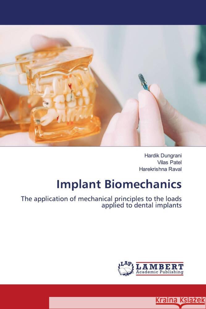 Implant Biomechanics Hardik Dungrani Vilas Patel Harekrishna Raval 9786205640685 LAP Lambert Academic Publishing - książka