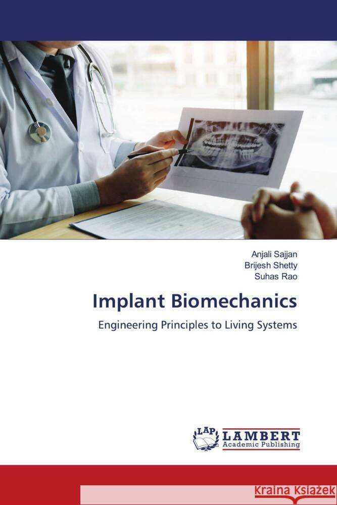 Implant Biomechanics Sajjan, Anjali, Shetty, Brijesh, Rao, Suhas 9786206166849 LAP Lambert Academic Publishing - książka