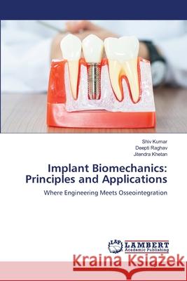 Implant Biomechanics: Principles and Applications Kumar, Shiv, Raghav, Deepti, KHETAN, JITENDRA 9783659636622 LAP Lambert Academic Publishing - książka