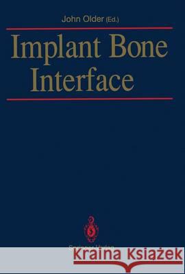 Implant Bone Interface John Older 9781447118138 Springer - książka