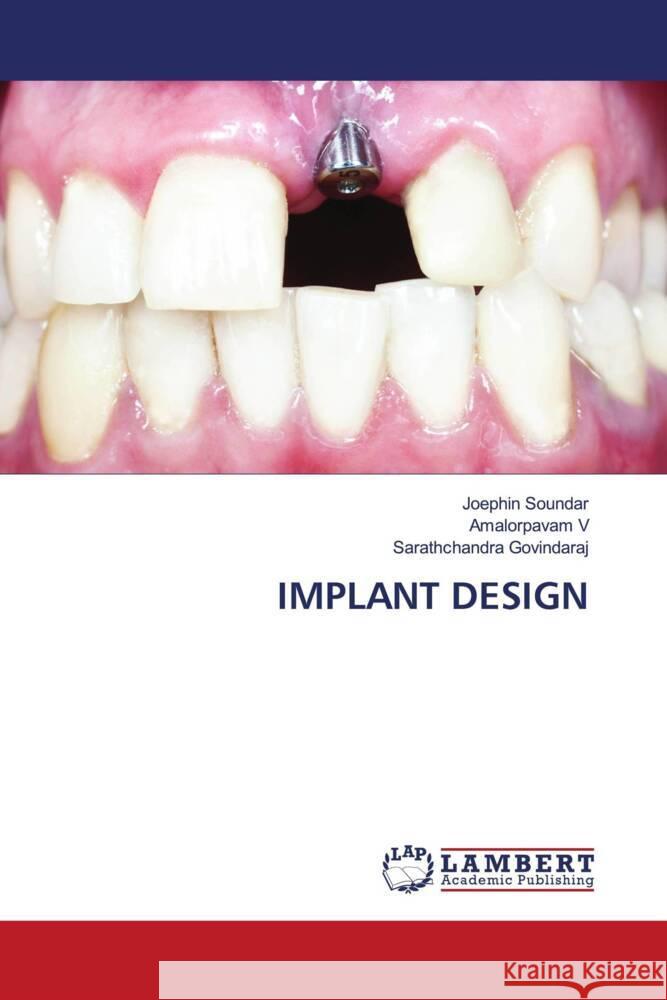 IMPLANT DESIGN SOUNDAR, Joephin, V, Amalorpavam, Govindaraj, Sarathchandra 9786207447268 LAP Lambert Academic Publishing - książka