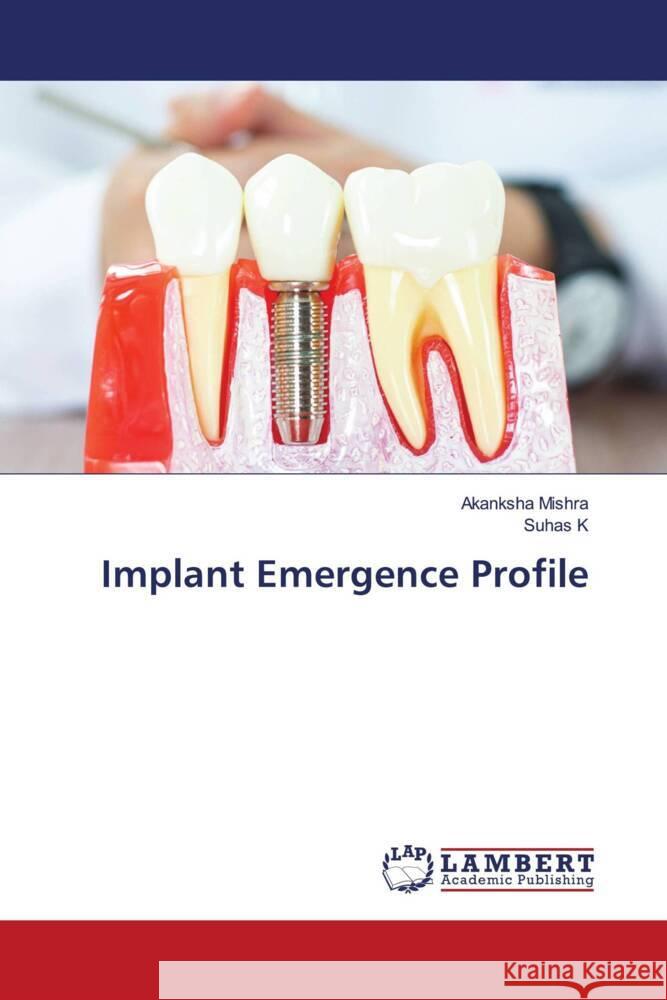 Implant Emergence Profile Akanksha Mishra Suhas K 9786208011550 LAP Lambert Academic Publishing - książka