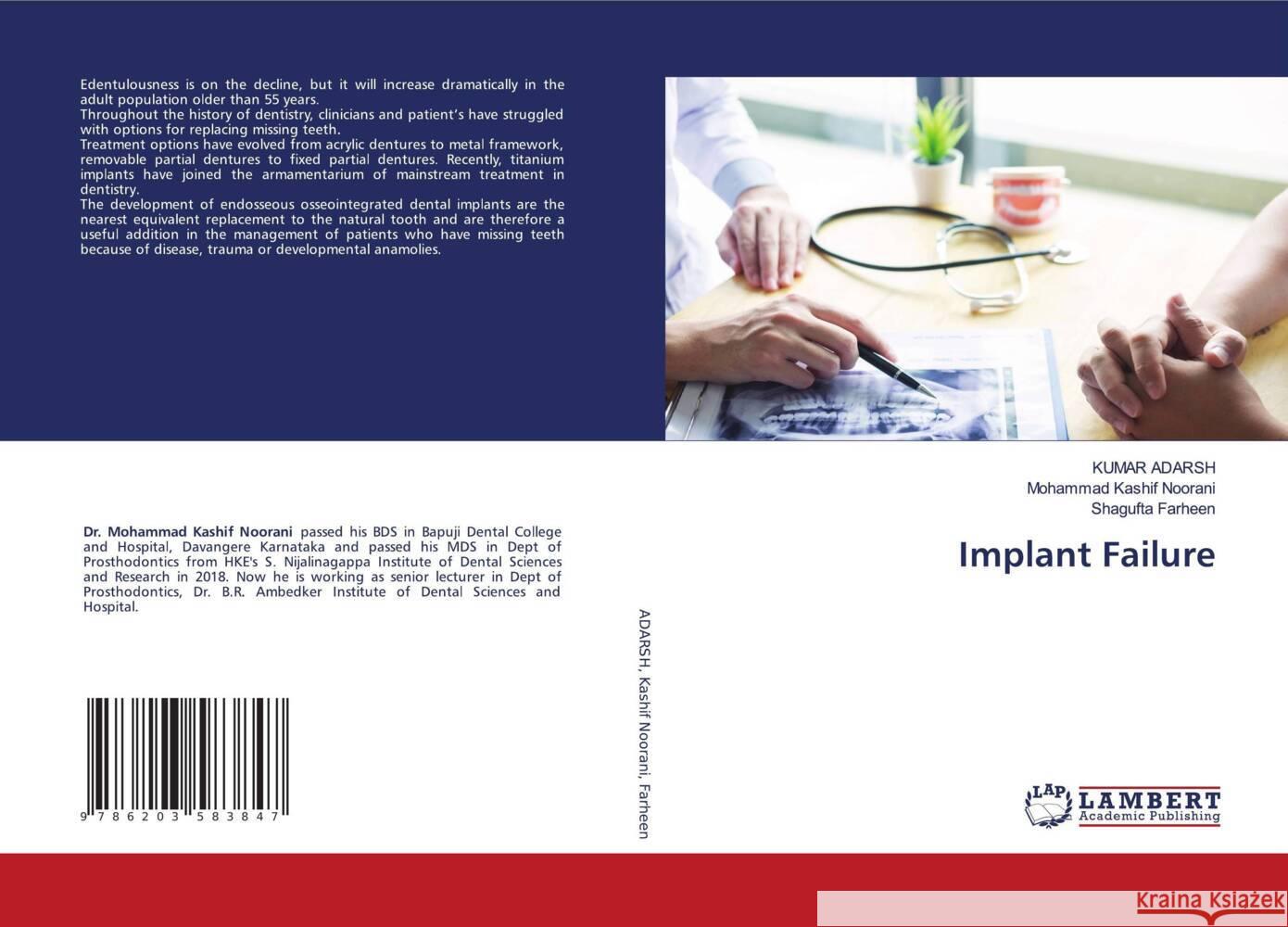 Implant Failure Adarsh, Kumar, Kashif Noorani, Mohammad, Farheen, Shagufta 9786203583847 LAP Lambert Academic Publishing - książka