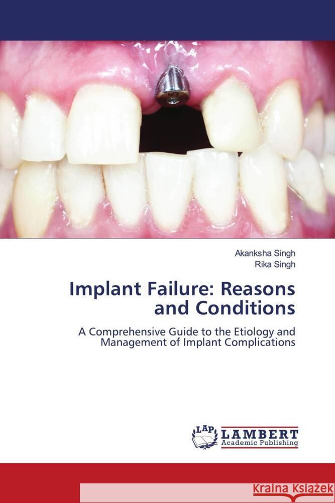 Implant Failure: Reasons and Conditions Singh, Akanksha, Singh, Rika 9786208442415 LAP Lambert Academic Publishing - książka