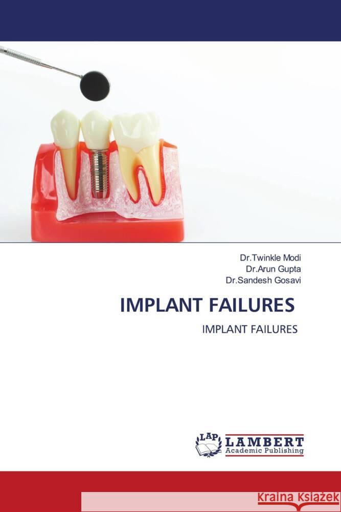 Implant Failures Dr Twinkle Modi Dr Arun Gupta Dr Sandesh Gosavi 9786207474547 LAP Lambert Academic Publishing - książka