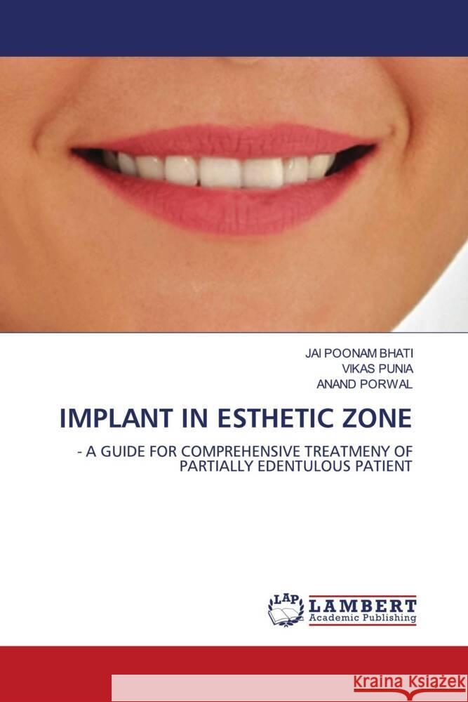 IMPLANT IN ESTHETIC ZONE BHATI, JAI POONAM, Punia, Vikas, Porwal, Anand 9786205630488 LAP Lambert Academic Publishing - książka