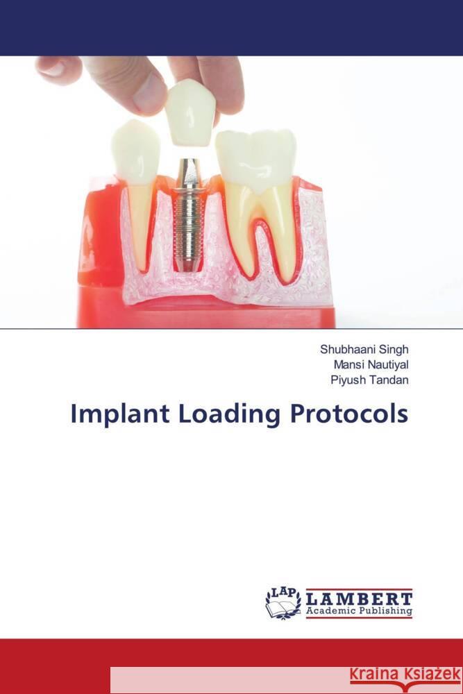 Implant Loading Protocols Singh, Shubhaani, Nautiyal, Mansi, Tandan, Piyush 9786204750132 LAP Lambert Academic Publishing - książka