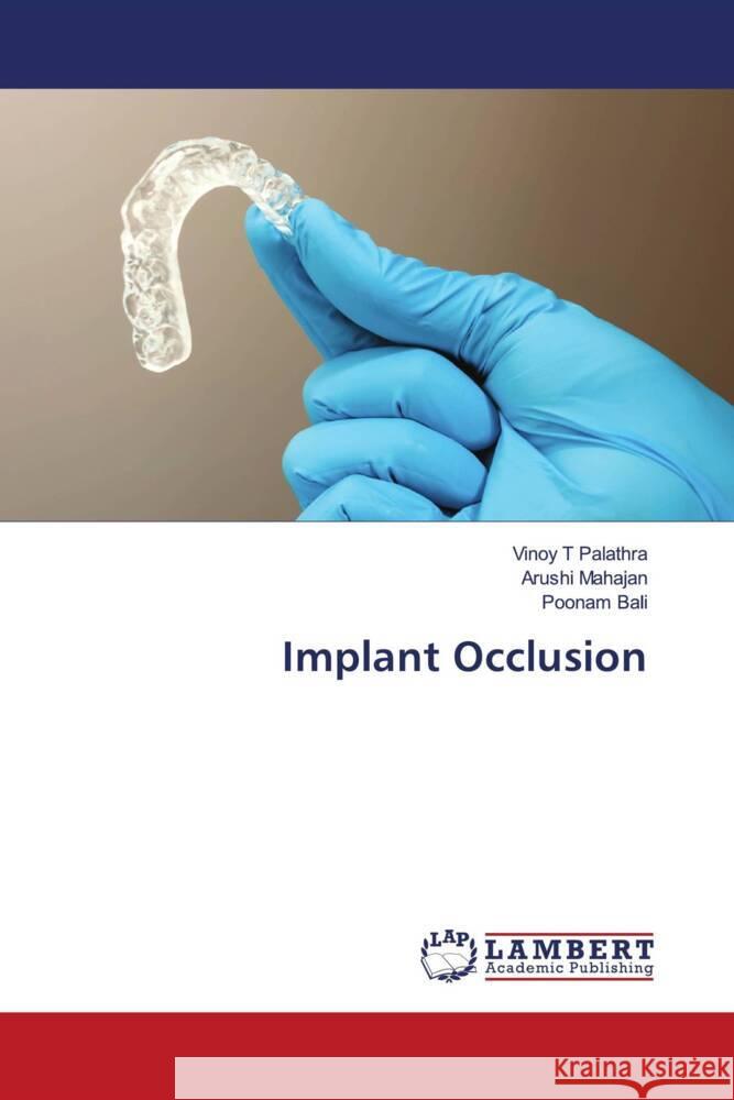 Implant Occlusion Palathra, Vinoy T, Mahajan, Arushi, Bali, Poonam 9786203926682 LAP Lambert Academic Publishing - książka