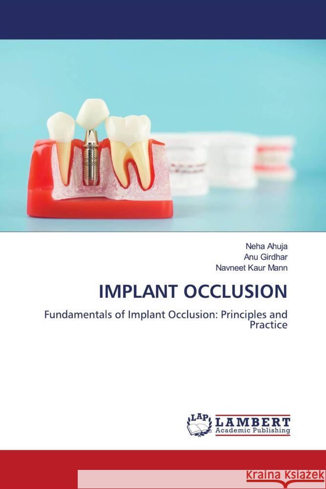 IMPLANT OCCLUSION Ahuja, Neha, Girdhar, ANU, Kaur Mann, Navneet 9786208427962 LAP Lambert Academic Publishing - książka