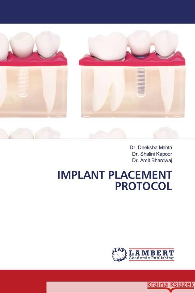 IMPLANT PLACEMENT PROTOCOL Mehta, Dr. Deeksha, Kapoor, Dr. Shalini, Bhardwaj, Dr. Amit 9786203195965 LAP Lambert Academic Publishing - książka