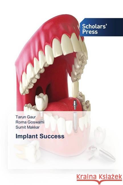 Implant Success Gaur, Tarun; Goswami, Roma; Makkar, Sumit 9786202309783 Scholar's Press - książka